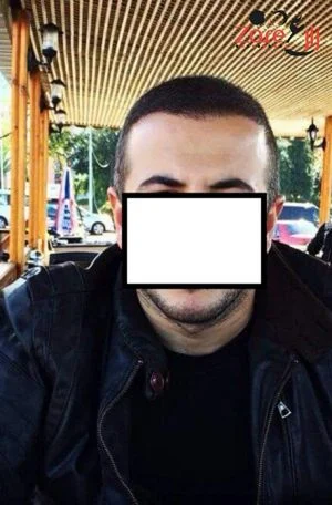  زراعة الشعر في تركيا للرجال - 3800 بصيلة - Zare3 (6).webp