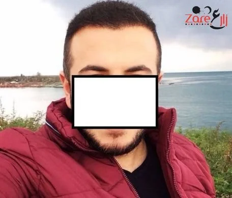  زراعة الشعر في تركيا للرجال - 3800 بصيلة - Zare3 (8).webp