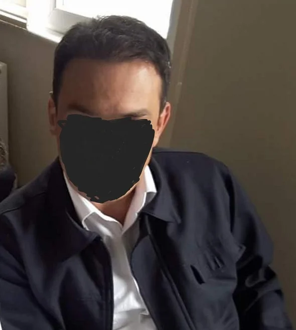  الشعر في تركيا للرجال مع قوتشلو.webp