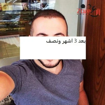  زراعة الشعر في تركيا للرجال - 3800 بصيلة - Zare3 (5).webp