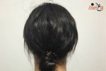 زراعة الشعر للنساء - خلف الرأس - Zare3.jpg